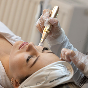 Microneedling